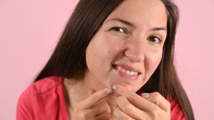 Boutons au visage : pourquoi devriez-vous éviter de les éclater - Conséquences